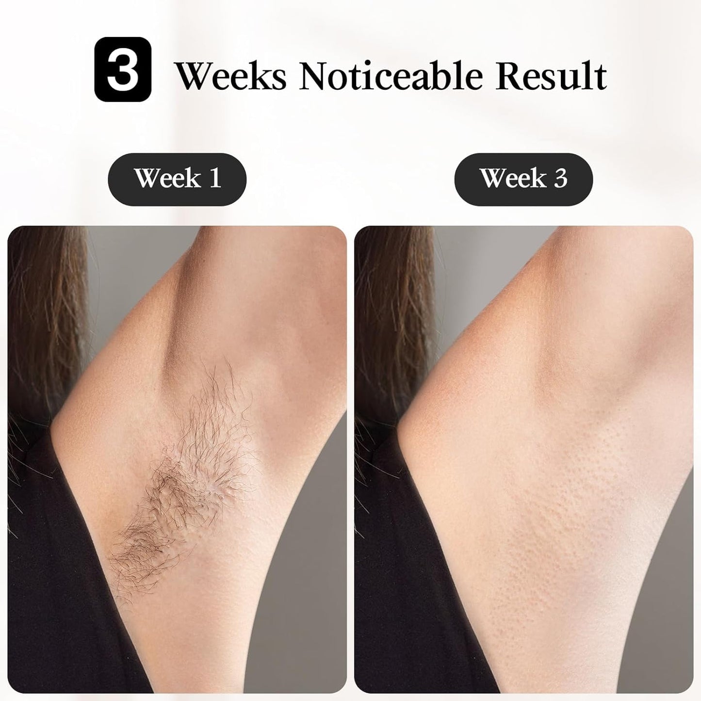 JOVS Venus Pro IPL Hair Removal for Women and Men - TECHTOYSHUB